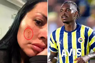 Fenerbahçe'li Lincoln'in Eşi Sokakta Saldırıya Uğradı!