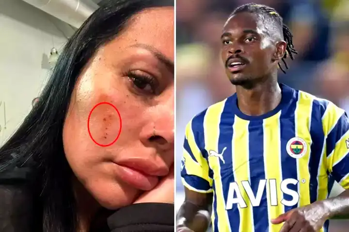 Fenerbahçe'li Lincoln'in Eşi Sokakta Saldırıya Uğradı!